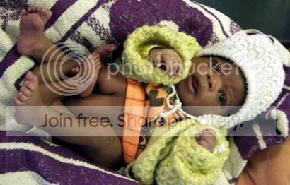 4leggedbaby12c8db6pb9.jpg